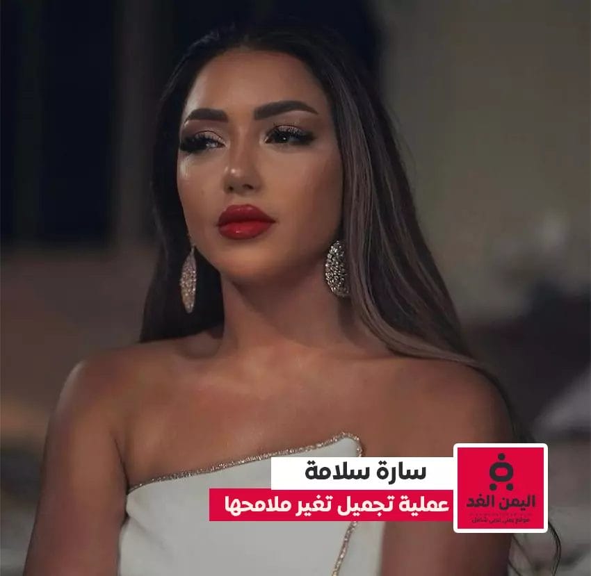قبل وبعد سارة سلامه بعد عمليه التجميل وحالة من الإنتقادات