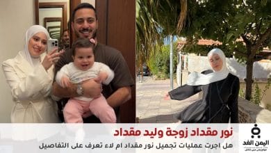 هل أجرت عملية تجميل نور مقداد زوجة وليد مقداد شاهد صور قبل وبعد 4 نور مقداد زوجة وليد